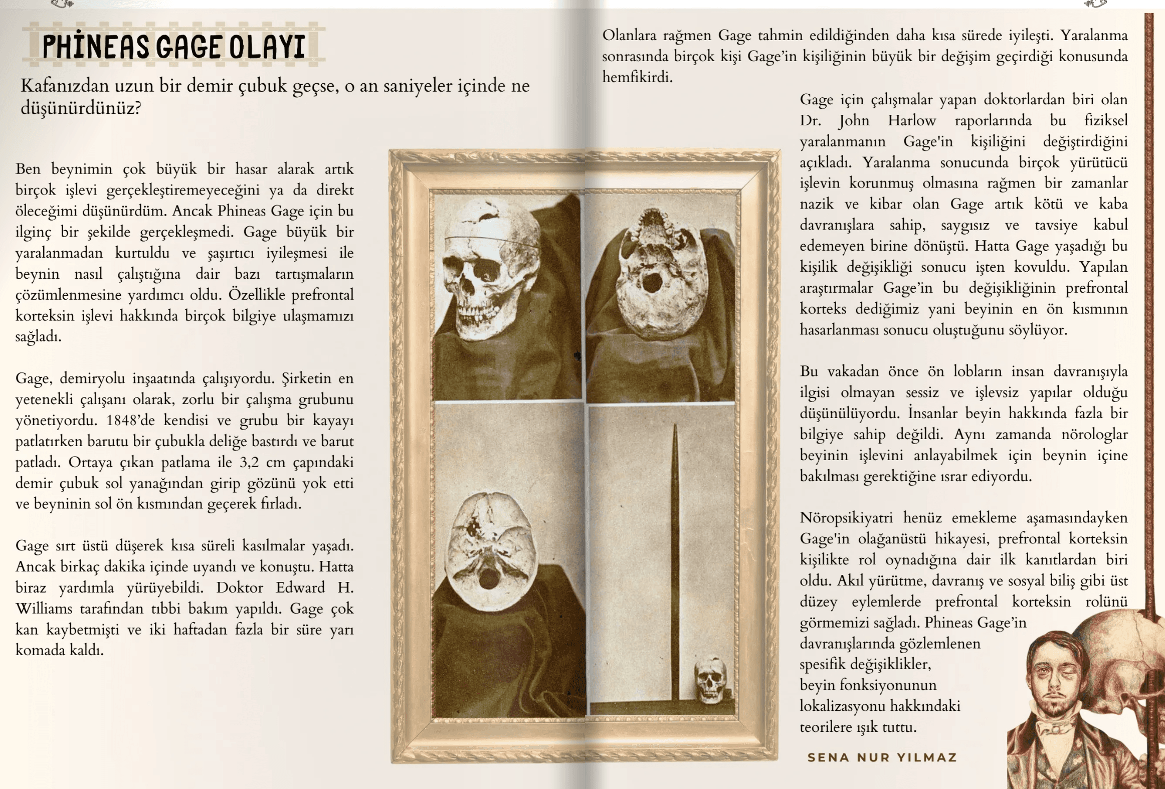 Phineas Gage Olayı — Linguinfo Dergisi'nde yayımlanmış nöropsikoloji yazısı